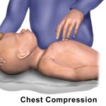 Learn Pediatric CPR at Texas CPR Training, CPR Dallas